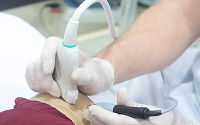 Ultrasound-Guided Interventions