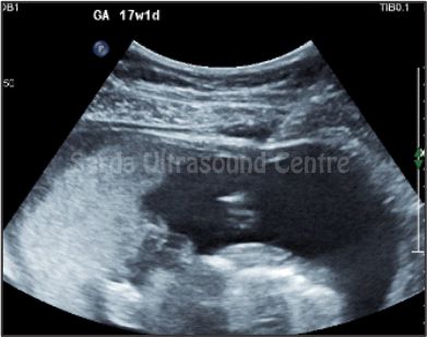 Ultrasound-Guided Interventions
